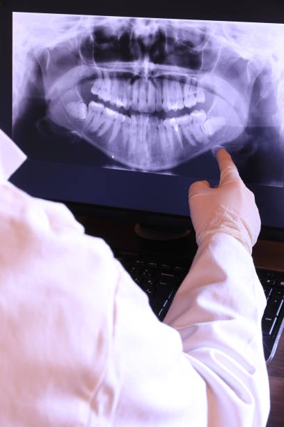 Best Emergency Dental Care for Sports Injuries in Warsaw, NC